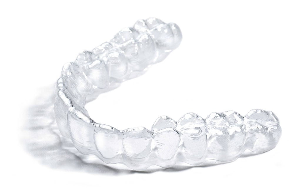 Clear Invisible Braces - Invisalign Clear Braces In North York